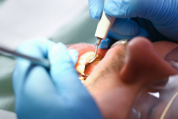 Best Emergency Dental Care for Abscessed Tooth in Greenville, RI